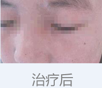 2-1P205164019A7.png