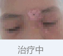 2-1P205164010562.png